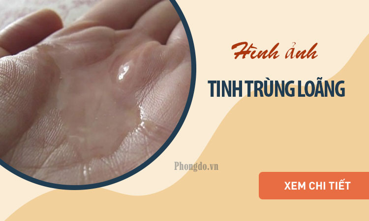 Tinh trùng yếu màu gì? 4 Tips nâng cao chất lượng tinh trùng